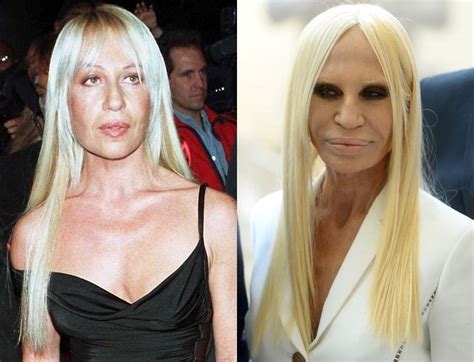 photos donatella versace jeune|donatella versace before and after.